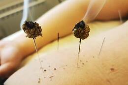 Akupeng Akupunktur & Massage
