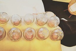 Akupeng Akupunktur & Massage